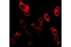 Immunofluorescent analysis of mPR gamma staining in LOVO cells. (PAQR5 抗体  (C-Term))