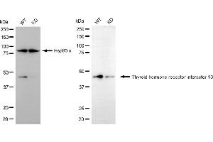Western blotting analysis using thyroid hormone receptor interactor 13 antibody (ABIN7800555). (TRIP13 抗体)