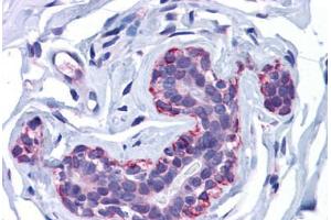 Human Breast: Formalin-Fixed, Paraffin-Embedded (FFPE) (FREM2 抗体  (Internal Region))