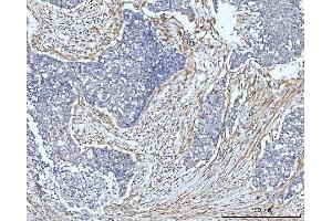 IHC analysis of FHL2 using anti-FHL2 antibody (ABIN7600782). (FHL2 抗体  (AA 234-279))