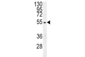 Western Blotting (WB) image for anti-Tubulin, beta 3 (TUBB3) (AA 36-63) antibody (ABIN3029345)