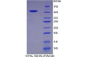 SDS-PAGE analysis of Rat Chromogranin B Protein. (CHGB 蛋白)