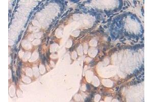 Detection of ANGPTL2 in Mouse Colon Tissue using Polyclonal Antibody to Angiopoietin Like Protein 2 (ANGPTL2) (ANGPTL2 抗体  (AA 267-493))