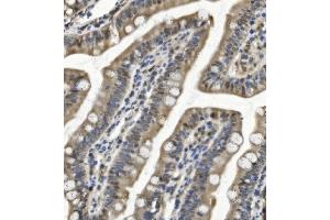IHC analysis of SAMHD1 using anti-SAMHD1 antibody (ABIN7601516).