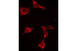 ABIN6274936 staining  HuvEc cells by IF/ICC. (PNPLA8 抗体  (C-Term))