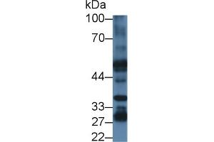 Detection of PSR in Mouse Liver lysate using Polyclonal Antibody to Phosphatidylserine Receptor (PSR) (JMJD6 抗体  (AA 1-334))