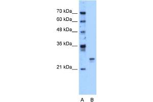 WB Suggested Anti-HMGB1 Antibody Titration:  1. (HMGB1 抗体  (Middle Region))