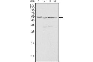 Western blot analysis using Calreticulin mouse mAb against Hela (1), A549 (2), NTERA2 (3) and MCF-7 (4) cell lysate. (Calreticulin 抗体)