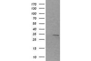 Image no. 1 for anti-Retinoic Acid Receptor Responder (Tazarotene Induced) 1 (RARRES1) antibody (ABIN1500602) (RARRES1 抗体)