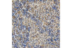 Immunohistochemistry (IHC) image for anti-DNA (Cytosine-5-)-Methyltransferase 3 alpha (DNMT3A) (AA 500-700) antibody (ABIN3022834)