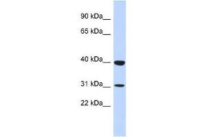 ZNF660 antibody used at 5 ug/ml to detect target protein. (ZNF660 抗体  (N-Term))