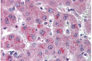 Human Liver (formalin-fixed, paraffin-embedded) stained with HTRA3 antibody ABIN296848 at 10 ug/ml followed by biotinylated goat anti-rabbit IgG secondary antibody ABIN481713, alkaline phosphatase-streptavidin and chromogen. (HTRA3 抗体  (AA 250-300))