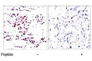 Image no. 1 for anti-Signal Transducer and Activator of Transcription 5A (STAT5A) (Ser780) antibody (ABIN197182)