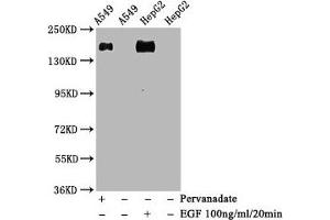 Western Blot Positive WB detected in A549 whole cell lysate 72epG2 whole cell lysate(treated with EGF or Pervanadate) All lanes Phospho-EGFR antibody at 1. (Recombinant EGFR 抗体  (pTyr1068))
