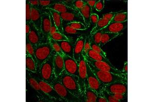 Confocal immunofluorescence image of HeLa cells using CD44 Mouse Monoclonal Antibody (156-3C11) Green (CF488) and Reddot is used to label the nuclei Red. (CD44 抗体)