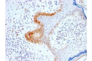 IHC testing of FFPE human skin with recombinant Cytokeratin 15 antibody (clone KRT15/2103R). (KRT15 抗体)