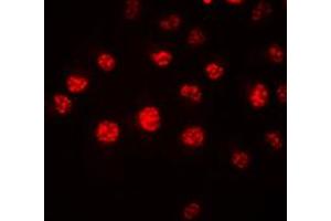 Immunofluorescent analysis of HOXA1 staining in HeLa cells. (HOXA1 抗体  (Center))
