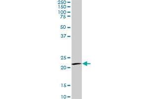 IL20 monoclonal antibody (M01), clone 2H8. (IL-20 抗体  (AA 67-176))