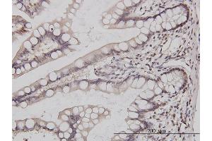 Immunoperoxidase of monoclonal antibody to GABPA on formalin-fixed paraffin-embedded human small Intestine. (GABPA 抗体  (AA 1-100))
