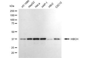Western blotting analysis using HIBCH antibody (ABIN7797421).