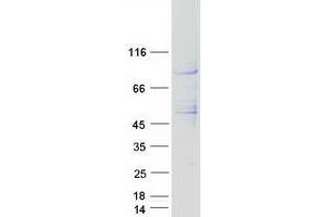 Validation with Western Blot