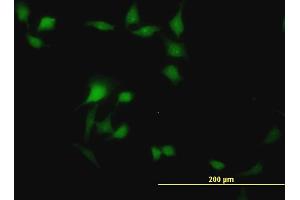 Immunofluorescence of monoclonal antibody to BOLL on HeLa cell. (BOLL 抗体  (AA 80-176))