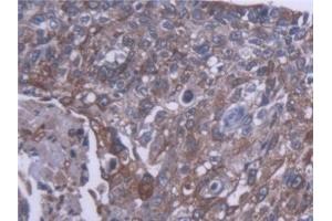 Immunohistochemistry (IHC) image for anti-Carboxylesterase 1 (CES1) (AA 18-299) antibody (ABIN7444436)