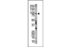 Image no. 1 for anti-Epidermal Growth Factor Receptor Pathway Substrate 8 (EPS8) (N-Term) antibody (ABIN360658) (EPS8 抗体  (N-Term))