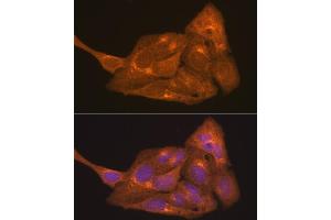 Immunofluorescence analysis of U2OS cells using RARα Rabbit pAb (ABIN6128615, ABIN6146692, ABIN6146695 and ABIN6213825) at dilution of 1:100 (40x lens). (Retinoic Acid Receptor alpha 抗体  (AA 1-457))