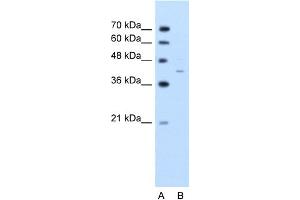 WB Suggested Anti-GNAS Antibody Titration:  2. (GNAS 抗体  (C-Term))