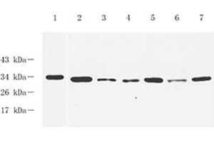 Western blot analysis of GTF2F2,(ABIN7074036) at dilution of 1: 1000,Lane 1: PC3 cell lysate,Lane 2: Mouse spleen tissue lysate,Lane 3: Mouse lung tissue lysate,Lane 4: Mouse testis tissue lysate,Lane 5: Rat spleen tissue lysate,Lane 6: Rat lung tissue lysate,Lane 7: Rat testis tissue lysate (GTF2F2 抗体)