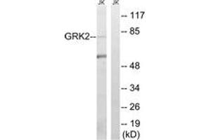 Western blot analysis of extracts from Jurkat cells, using GRK2 (Ab-685) Antibody.