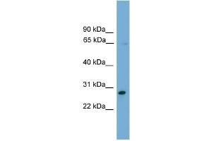 WB Suggested Anti-ZNF37A Antibody Titration:  0. (ZNF37A 抗体  (Middle Region))