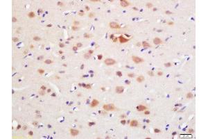 Formalin-fixed and paraffin embedded rat brain labeled with Rabbit Anti-DAL1 Polyclonal Antibody, Unconjugated (ABIN761021) at 1:200 followed by conjugation to the secondary antibody and DAB staining (EPB41L3 抗体)