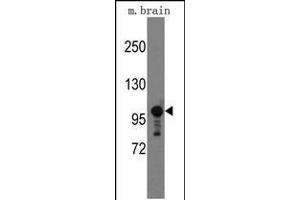 Western blot analysis of mouse anti-Semaphorin 5A Pab (ABIN389166 and ABIN2839332) in mouse brain tissue lysates (35 μg/lane). (SEMA5A 抗体  (AA 1006-1035))