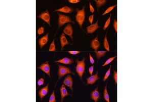 Immunofluorescence (IF) image for anti-Exosome Component 2 (EXOSC2) (AA 1-293) antibody (ABIN6140374)
