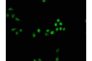 Immunofluorescence staining of Hela cells with ABIN7160246 at 1:33, counter-stained with DAPI. (SMAD7 抗体  (AA 36-247))