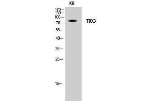 Western Blotting (WB) image for anti-T-Box 3 (TBX3) (Internal Region) antibody (ABIN3177644) (TBX3 抗体  (Internal Region))