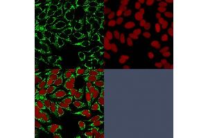 Immunofluorescence (IF) image for anti-Hypoxia Inducible Factor 1, alpha Subunit (Basic Helix-Loop-Helix Transcription Factor) (HIF1A) antibody (ABIN6939615)