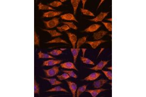 Immunofluorescence analysis of L929 cells using MRPS14 antibody (ABIN7270013) at dilution of 1:100. (RPS14 抗体  (AA 1-128))