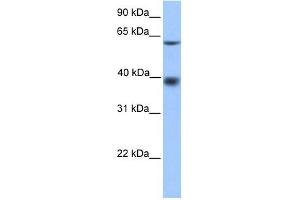 MFSD4 antibody used at 1 ug/ml to detect target protein. (MFSD4 抗体  (N-Term))