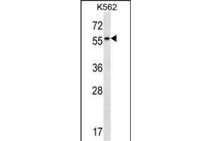 RARB Antibody (Center) (ABIN1537931 and ABIN2849656) western blot analysis in K562 cell line lysates (35 μg/lane). (Retinoic Acid Receptor beta 抗体  (AA 168-195))