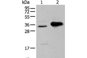 Western blot analysis of TM4 cell and Mouse brain tissue using ATP6V1E2 Polyclonal Antibody at dilution of 1:400 (ATP6V1E2 抗体)