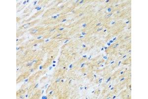 Immunohistochemistry of paraffin-embedded Rat heart using BAG3 Polyclonal Antibody at dilution of 1:100 (40x lens). (BAG3 抗体)