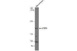 WB Image LTBP4 antibody detects LTBP4 protein by western blot analysis. (LTBP4 抗体  (N-Term))