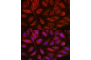 Immunofluorescence analysis of U2OS cells using Endothelin 1 Rabbit pAb (ABIN3021075, ABIN3021076, ABIN3021077 and ABIN6213940) at dilution of 1:50 (40x lens). (Endothelin 1 抗体  (AA 18-212))