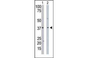 The anti-PDXK Pab (ABIN391110 and ABIN2841241) is used in Western blot to detect PDXK in mouse intestine tissue lysate (Lane 1) and Hela cell lysate (Lane 2). (PDXK 抗体  (N-Term))