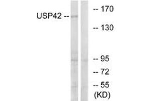 Western blot analysis of extracts from HT-29 cells, using USP42 Antibody. (USP42 抗体  (AA 251-300))