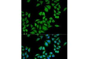 Immunofluorescence analysis of U2OS cells using QDPR Polyclonal Antibody (QDPR 抗体)