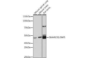 Western blot analysis of extracts of various cell lines, using SM/SNF5 Rabbit mAb (ABIN7270657) at 1:1000 dilution. (SMARCB1 抗体)